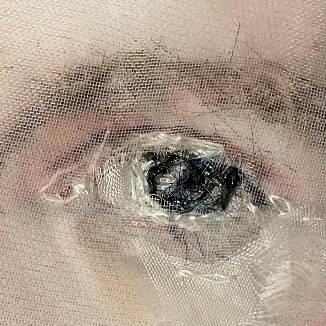 Stacey Chapman, Her Majesty’s stitched eye.