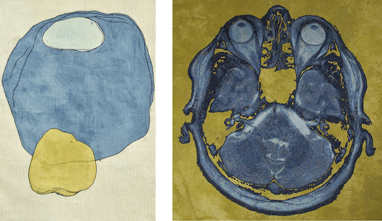 Karen Rips & Paula Chung, Listen Up and Inner Ear I, 2015