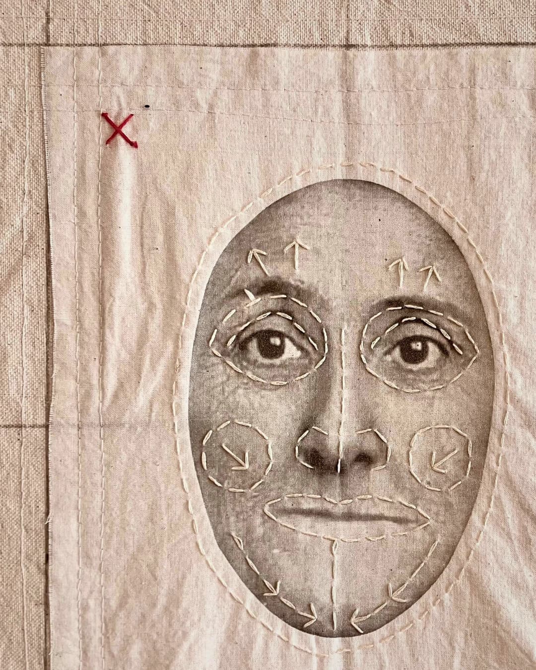 a face inside a piece of cloth with surgical corrections stitched onto it.